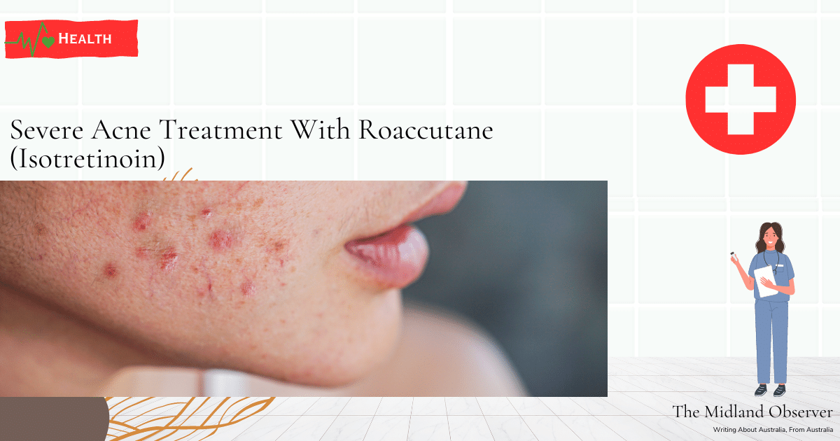 Read more about the article Severe Acne Treatment With Roaccutane (Isotretinoin)